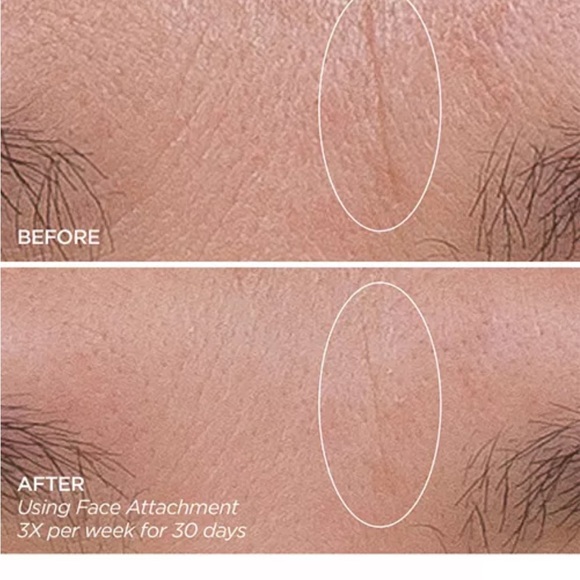 NIB $199 Get That Glow GloPRO® Microneedling Tool & Discovery Gift Set - Picture 6 of 7